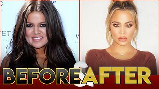 Khloe Kardashian | Before & After Transformation ( Fitness, Surgery, Pregnancy )