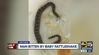Valley man bitten by baby rattlesnake