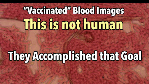 More "vaccinated" blood images: Accomplished Goal to Change what is Human w/ Maryam Henein