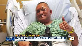 Police officer recovering after violent attack