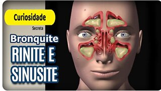 Qual a Diferença Entre Rinite, Sinusite e Bronquite