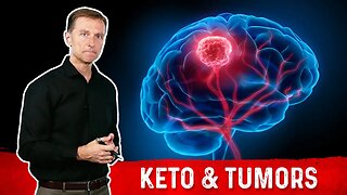 Can the Ketogenic Diet Cause Brain Tumors (Glioblastomas)?