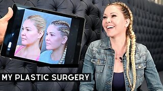 Stars removing fillers and botox - NEW plastic surgery trends | Shanna Moekler did it