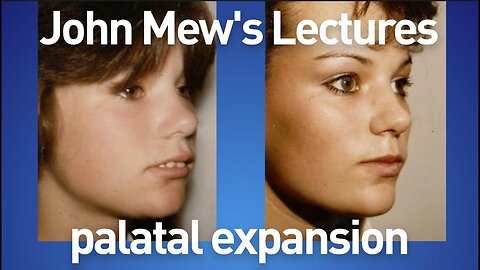 John Mew's lectures part 18: palatal expansion
