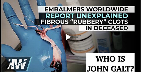 DEL BIGTREE-EMBALMERS WORLDWIDE REPORT UNEXPLAINED FIBROUS “RUBBERY” CLOTS IN DECEASED. TY JGANON