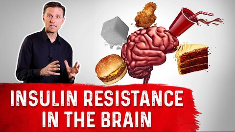 Insulin Resistance of the Brain – Dr. Berg