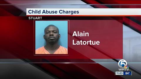 Alain Latortue: Man charged with child abuse in Stuart