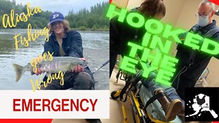 Alaskan Salmon Fishing goes Wrong | Hooked in the eye and emergency surgery | the Eye update