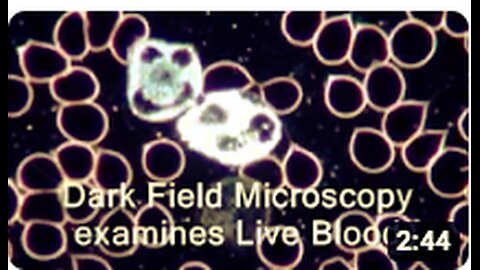 Live Blood Analysis Dark Field Microscopy explained 2
