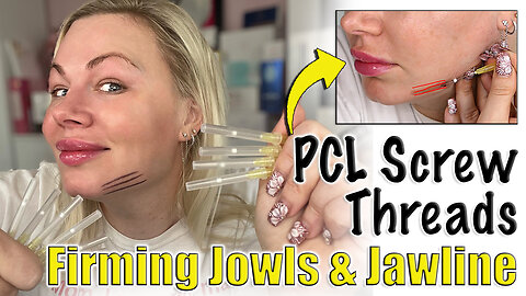 Tighten Jowls with PCL Screw Threads! AceCosm | Code Jessica10 saves you Money $$$