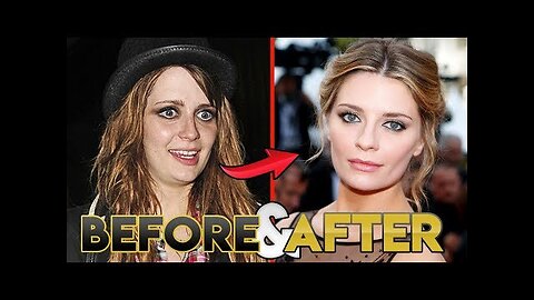 Mischa Barton | Before and After Transformations | The Hills: New Beginnings