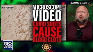 Alex Jones: Pathologist Proves Covid Shot Causes Blood Clots - 12/22/22