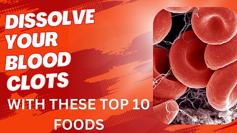 Top 10 Foods To Dissolve Your Blood Clots
