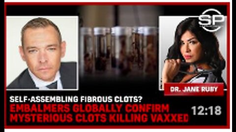 Self-Assembling Fibrous Clots? Embalmers Globally Confirm Mysterious Clots Killing Vaxxed