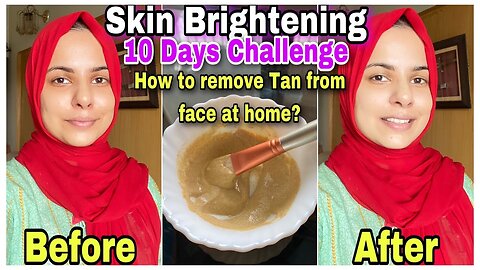 10 Days “FACE TAN REMOVAL” CHALLENGE | Skin Brightening Sun Tan Removal Natural Home Remedy