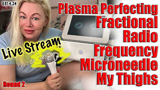 LIVE Plasma Perfecting Micro Needle Fractional Radio Frequency Device on Thighs: Round 2 | save $500