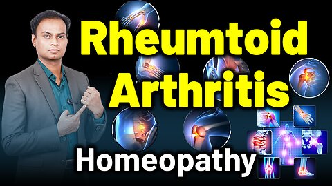 Rheumtioid Arthritis ,Chronic Inflammatory Arthritis | Dr. Bharadwaz | Homeopathy,Treatment and Cure