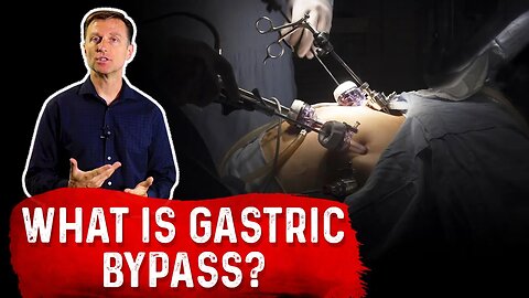 What is Gastric Bypass? – Dr. Berg