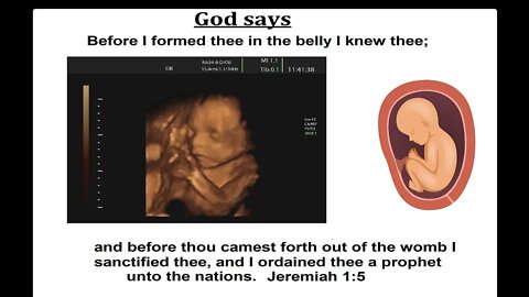 BIBLE SAYS ABORTION IS MURDER - CHRISTIAN TEACHING - GOD JUDGES LIFE IN THE WOMB - A LIVING SOUL