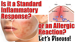 Is it a Standard Inflammatory Response or an Allergic Reaction? | Code Jessica10 saves you Money $$$