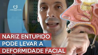 Nariz Entupido Pode Levar a Deformidade Facial e Dentaria