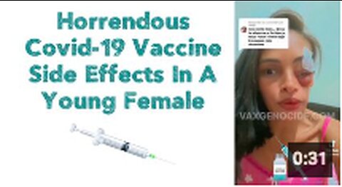 Horrendous Covid-19 Vaccine Side Effects In A Young Female 💉