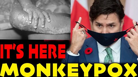 🚨BREAKING NEWS🚨 IT'S HERE! A NEW VIRUS CALLED MONKEYPOX