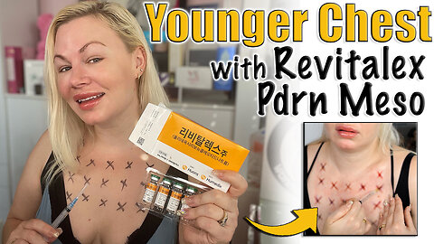 Younger Chest with Revitalrex Pdrn Meso from Celestapro | Code Jessica10 saves you money $$$