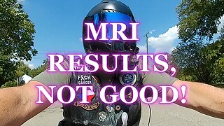MRI RESULTS, NOT GOOD!