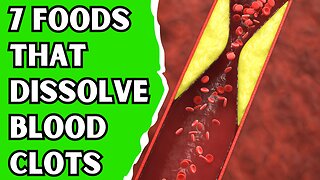 Top 7 Foods That DISSOLVE Blood Clots (Naturally)