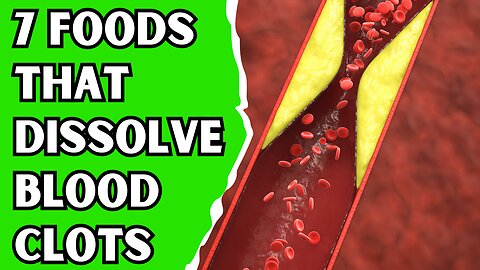 Top 7 Foods That DISSOLVE Blood Clots (Naturally)