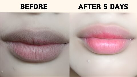 How to get pink lips | lighten dark lips | Causes and treatment of dark lips