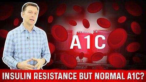 Normal A1C But Why Do I have Insulin Resistance? – Dr. Berg