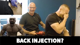 They Injected THIS Into My Back?! | Hardcore and SHREDDED Chest Training