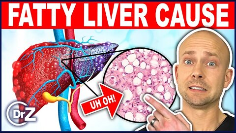 #1 WORST Cause of Fatty Liver Disease