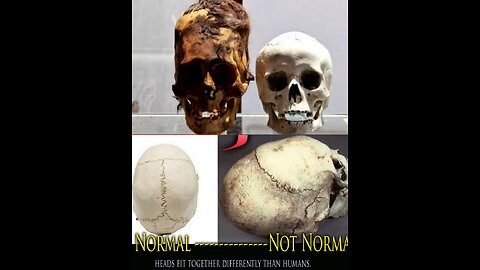 Nephilim human angel hybrids with elongated skulls - Hidden History