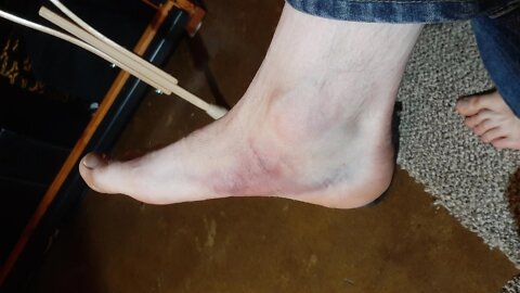 Sprained My Foot - A Rough Week