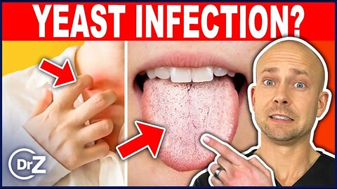 10 Warning Signs You Have A Candida Infection