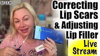 Live Correcting Lip Scars & Adjusting Lip Filler, Rejuran S & Liporase! AceCosm, Code Jessica10