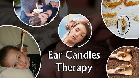 The Ear Candles Therapy.
