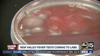 New Valley Fever tests coming to labs