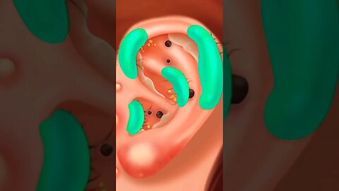 ear cleaning asmr 😲😲🏥 #gaming #asmr #shorts @sithugameworld582