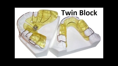 Twin Block Appliances by Prof John Mew