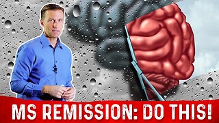 How To Put Multiple Sclerosis (MS) In Remission? – Dr.Berg