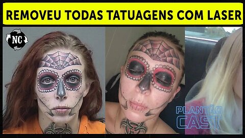 Lembra da mulher que se arrependeu das tatuagens faciais? Ela removeu todas com laser: “Finalmente..