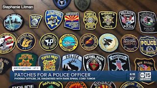 Family seeks patches for Phoenix police officer battling rare condition