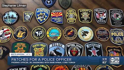 Family seeks patches for Phoenix police officer battling rare condition