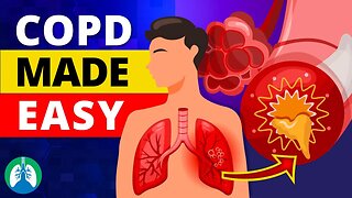 COPD Explained - Types, Causes, Symptoms, and Treatment ❗