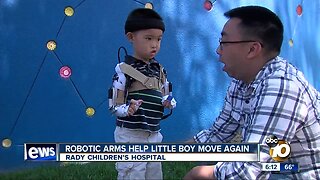 Robotic arms help San Diego boy move again