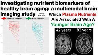 Which Nutrients Are Associated With A Younger Brain Age?